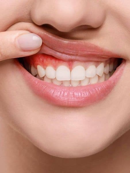 Periodontics and Gum Treatment